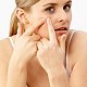 Acne Cleansers as Treatment Option for Acne