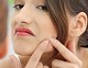 Common acne mistakes