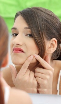 Common Acne Mistakes