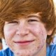 Oral Antibiotics in Acne Treatment